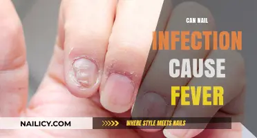 Exploring the Link: Can Nail Infections Trigger Fever Symptoms?