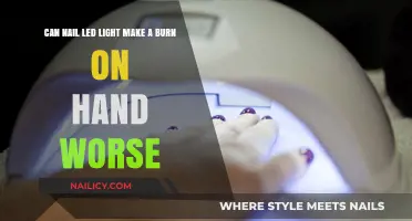 Can Nail LED Light Worsen Hand Burns? Facts and Safety Tips