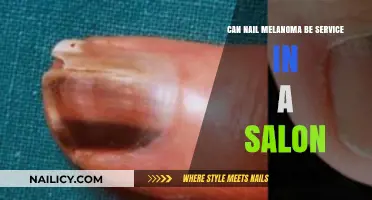 Melanoma Detection: Can Nail Salons Play a Role?