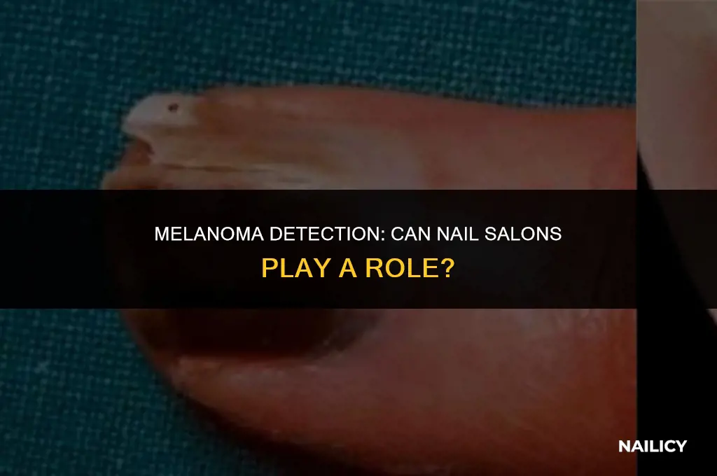 can nail melanoma be service in a salon