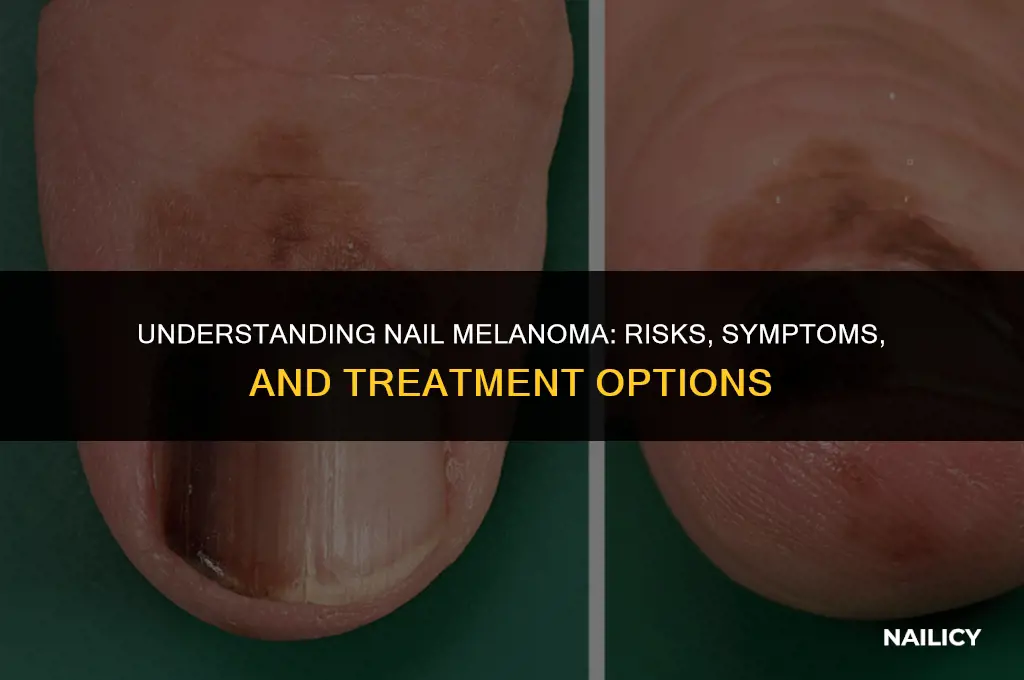 can nail melanoma kill you