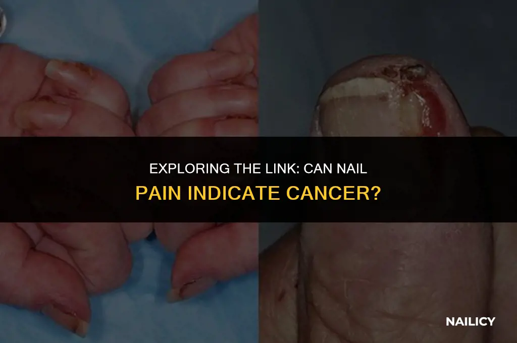 can nail pain be a symptom if cancer