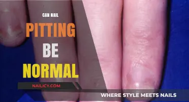 Is Nail Pitting Normal? Understanding Your Nail Health