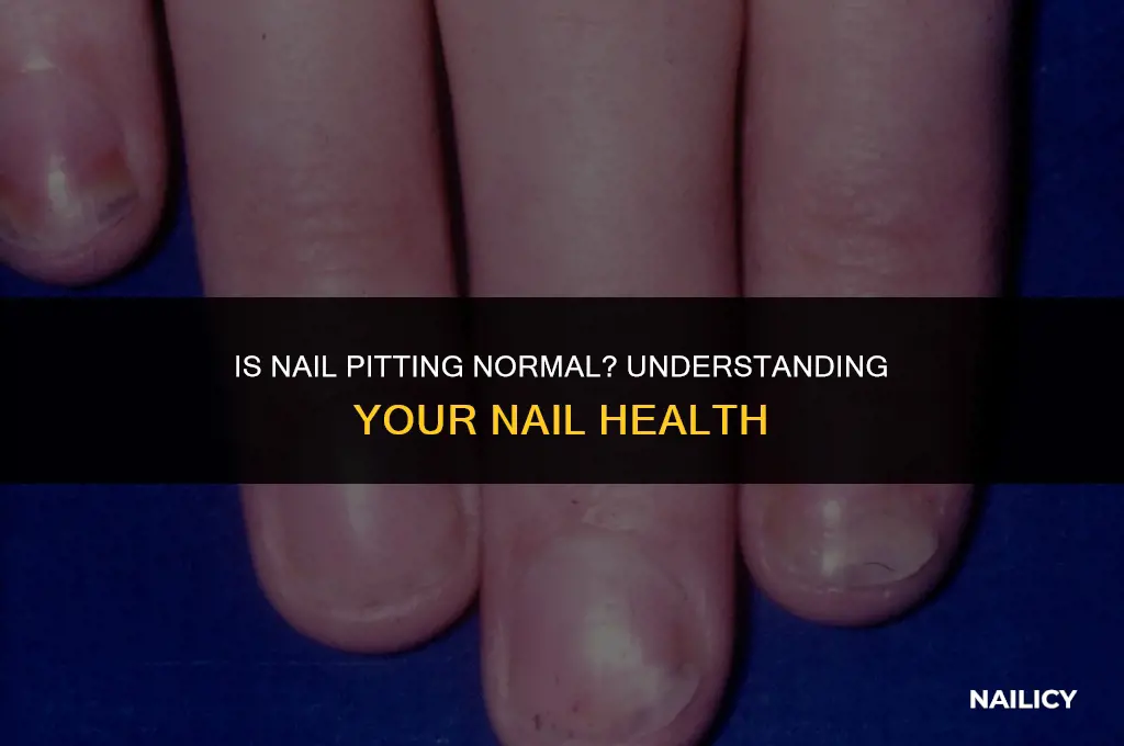 can nail pitting be normal