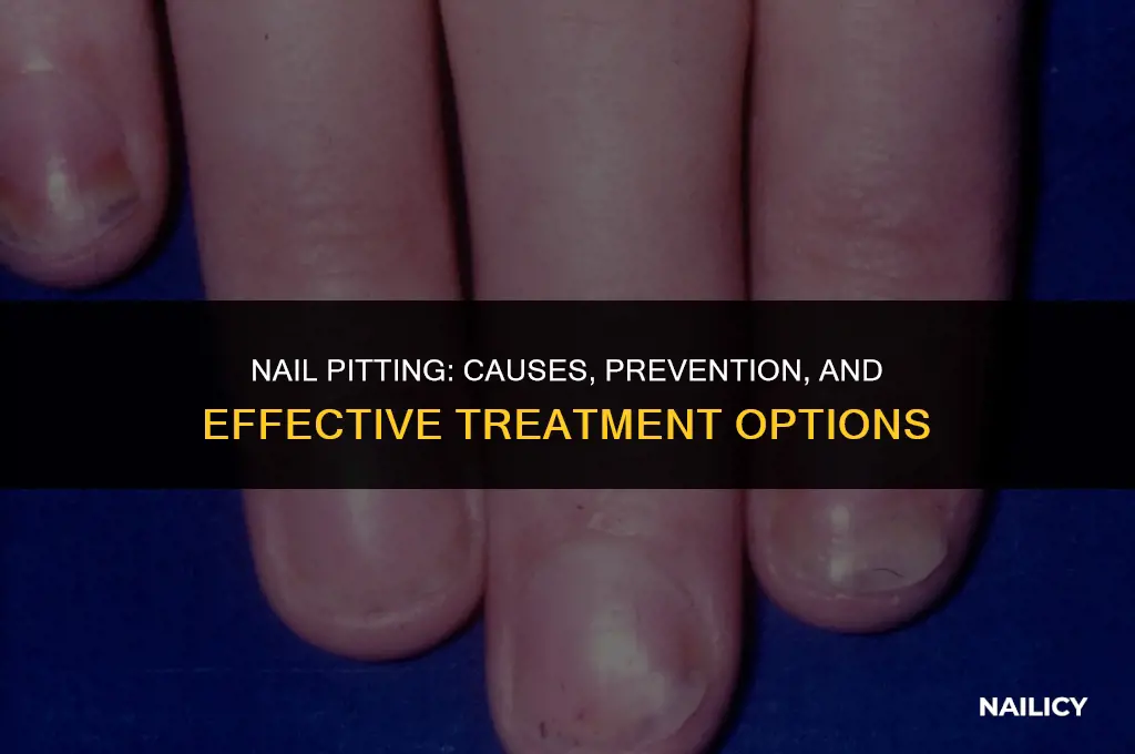 can nail pitting go away
