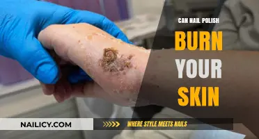 Can Nail Polish Burn Skin? Understanding Risks and Safe Practices