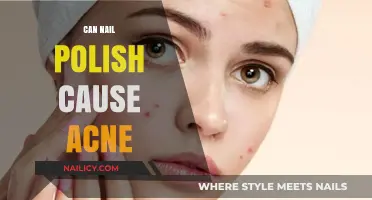 Can Nail Polish Trigger Acne? Uncovering the Surprising Connection