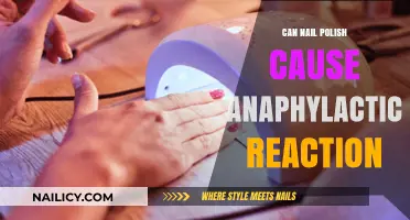 Can Nail Polish Trigger Anaphylaxis? Uncovering the Allergic Reaction Risk