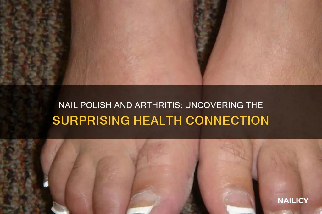 can nail polish cause arthritis