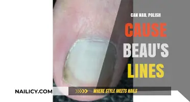 Can Nail Polish Trigger Beau's Lines? Uncovering the Surprising Connection