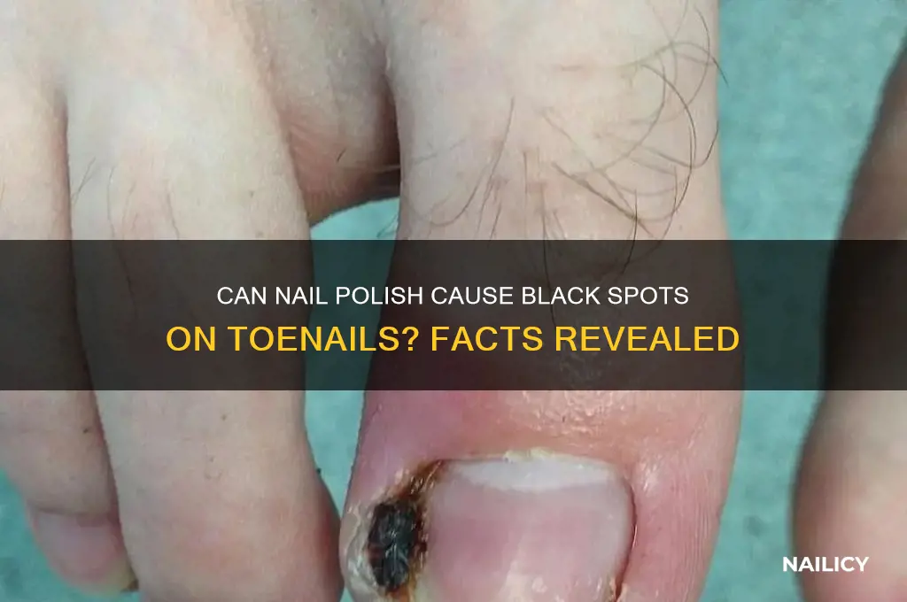 can nail polish cause black spots on toenails