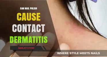 Can Nail Polish Trigger Contact Dermatitis? Uncovering the Skin Irritation Link