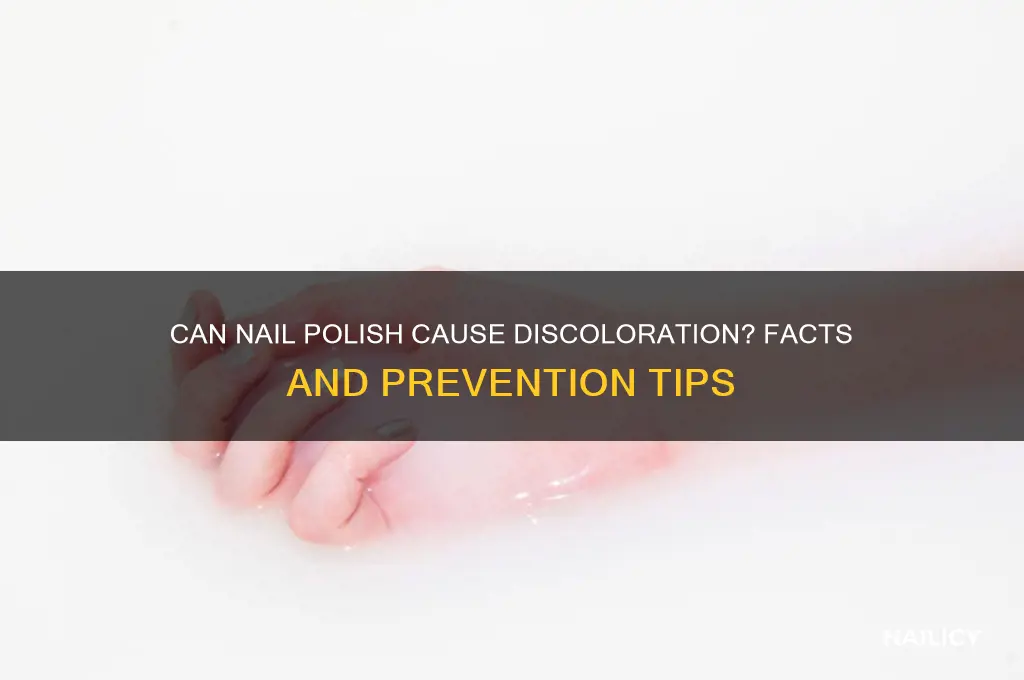 can nail polish cause discoloration