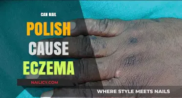 Can Nail Polish Trigger Eczema? Understanding the Skin Connection