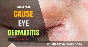 Nail Polish and Eye Dermatitis: Uncovering the Surprising Connection