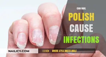 Can Nail Polish Lead to Infections? Risks and Prevention Tips