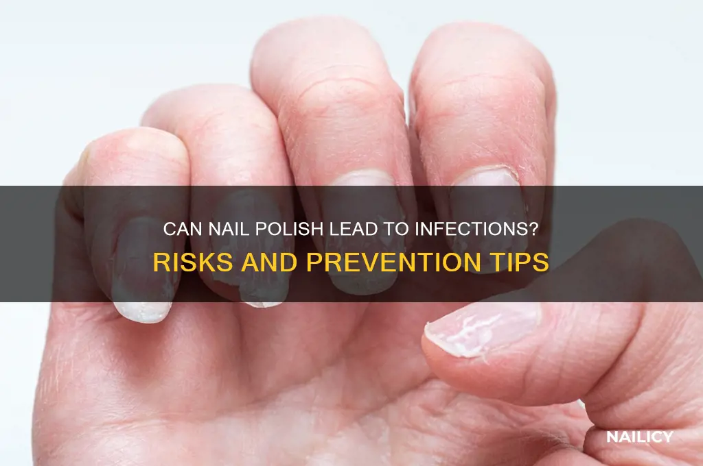 can nail polish cause infections