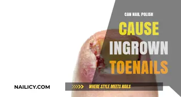 Nail Polish and Ingrown Toenails: Uncovering the Surprising Connection