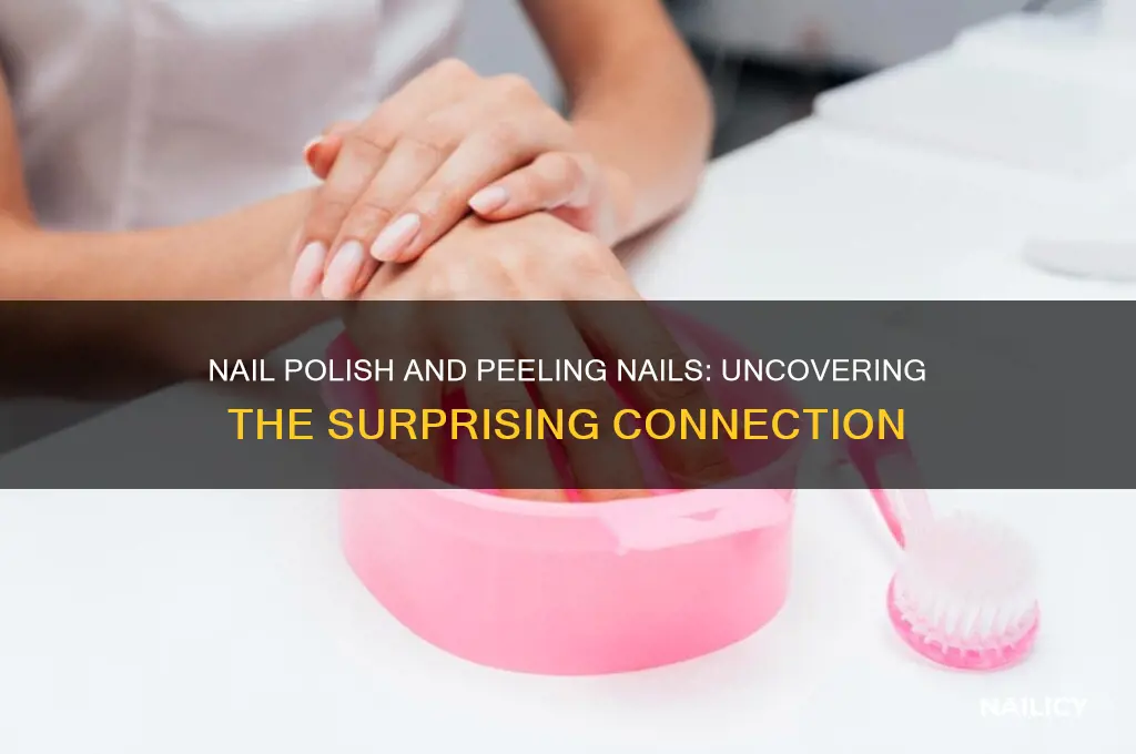 can nail polish cause nails to peel