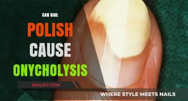 Nail Polish and Onycholysis: Uncovering the Potential Connection