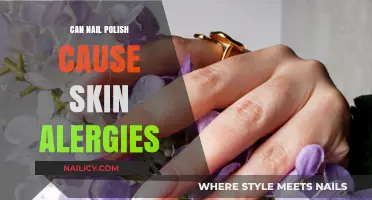 Nail Polish and Skin Allergies: Uncovering the Hidden Risks