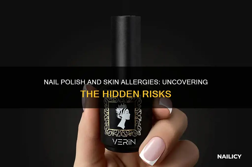 can nail polish cause skin alergies
