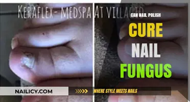 Can Nail Polish Treat Toenail Fungus? Separating Fact from Fiction