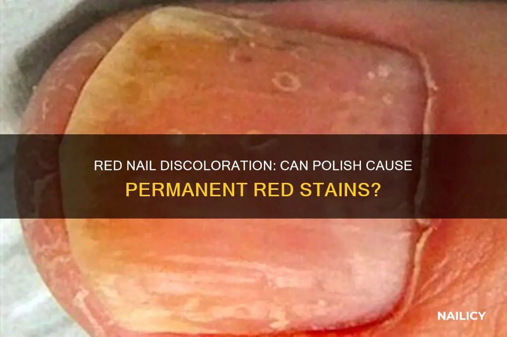 can nail polish discolor your nails the color red