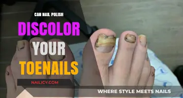 Can Nail Polish Cause Toenail Discoloration? Facts and Prevention Tips