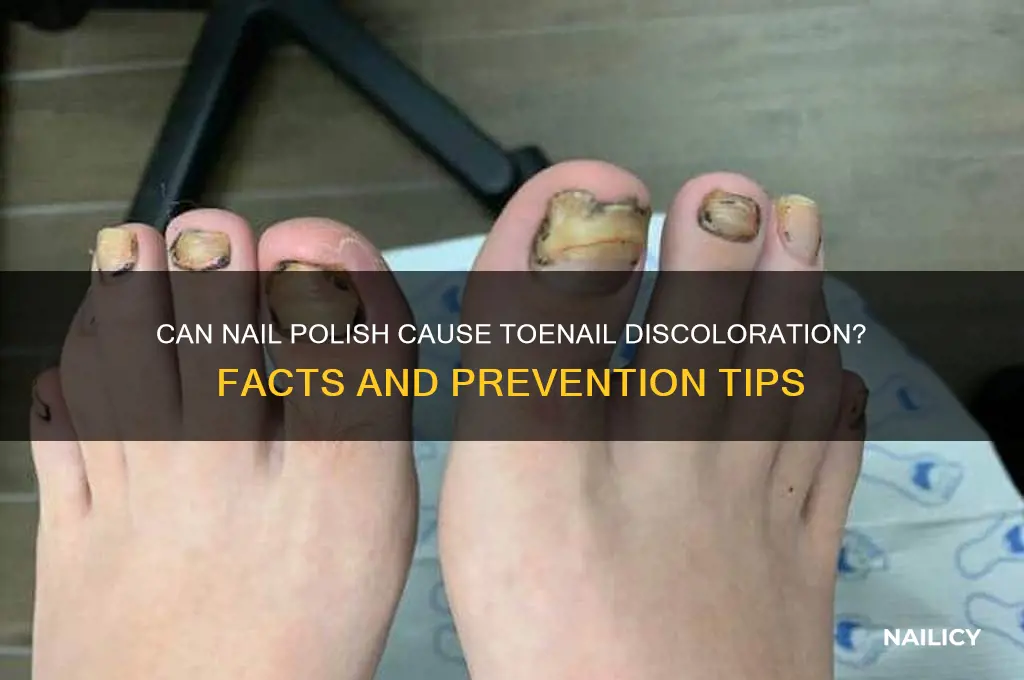 can nail polish discolor your toenails