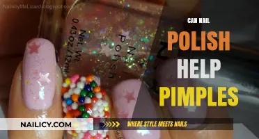 Nail Polish for Pimples: Unlikely Acne Hack or Myth?