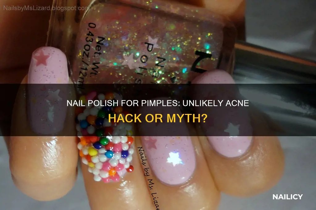 can nail polish help pimples