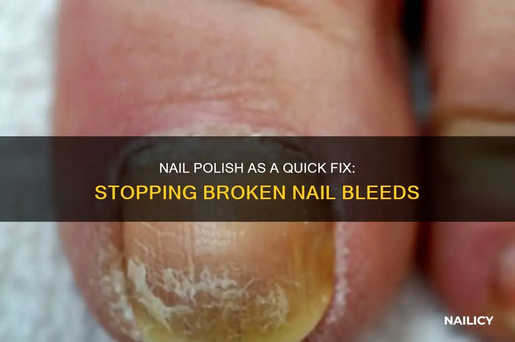 can nail polish help prevent a broken nail from bleeding