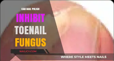 Can Nail Polish Stop Toenail Fungus? Uncovering the Truth