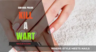 Can Nail Polish Kill a Wart? Uncovering the Truth Behind the Myth