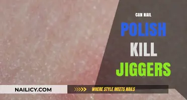 Can Nail Polish Eliminate Jiggers? Uncovering the Truth Behind the Myth