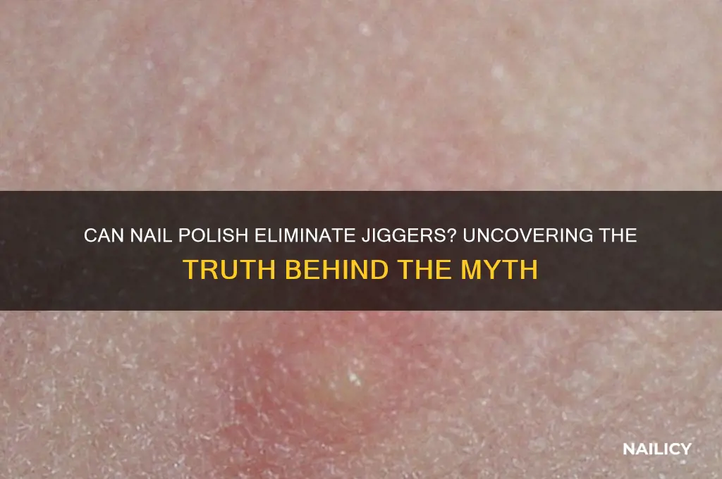 can nail polish kill jiggers