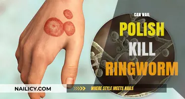 Can Nail Polish Kill Ringworm? Debunking Myths and Safe Treatments