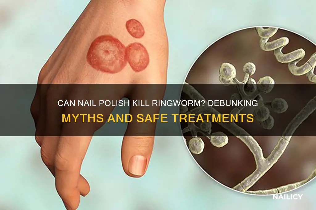 can nail polish kill ringworm