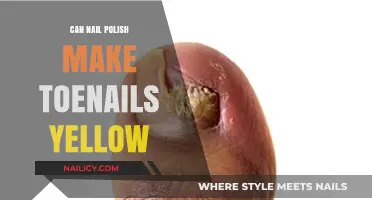Does Nail Polish Cause Toenail Yellowing? Facts and Prevention Tips