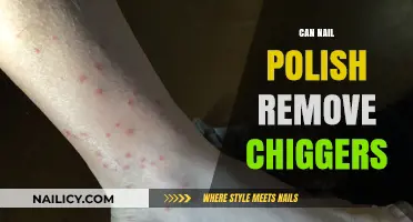 Nail Polish: Chigger Removal Solution?