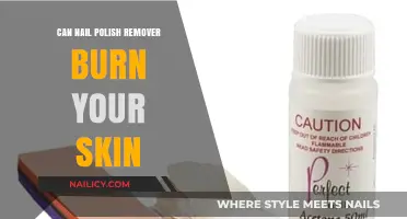 Nail Polish Remover: Skin Burns and Precautions