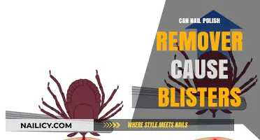 Nail Polish Remover: The Blistering Truth