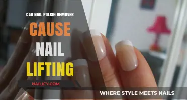 Nail Polish Remover: The Cause of Your Nail Lifting?