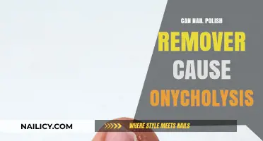 Nail Polish Remover: A Cause of Onycholysis?