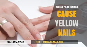 Nail Polish Remover: The Reason Behind Yellow Nails
