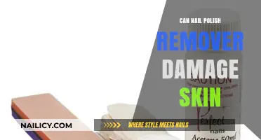 Nail Polish Remover: Is It Damaging Your Skin?