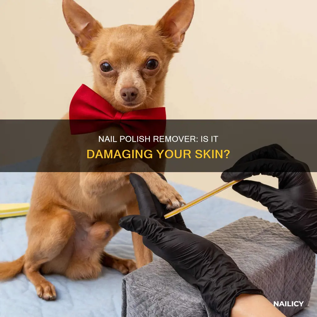 can nail polish remover damage skin