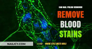 Nail Polish Remover: An Effective Blood Stain Remover?