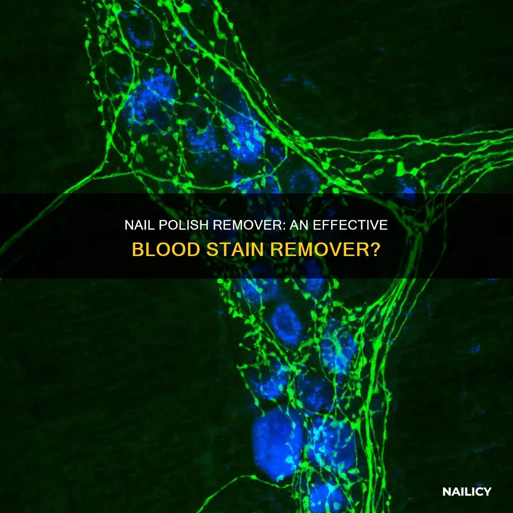 can nail polish remover remove blood stains